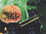 Marijuana Causes Brain Damage Pictures