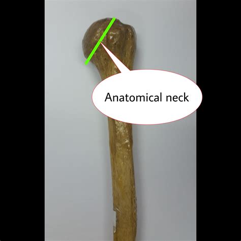 گردن آناتومیک اطلس الکترونیک آناتومی