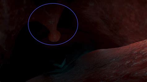 They look down the throat and see the whale's uvula. Image - Nemo whale uvula circled.png | Disney Wiki | FANDOM powered by Wikia