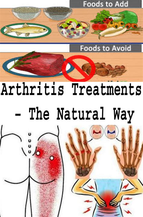 Arthritis Treatments The Natural Way
