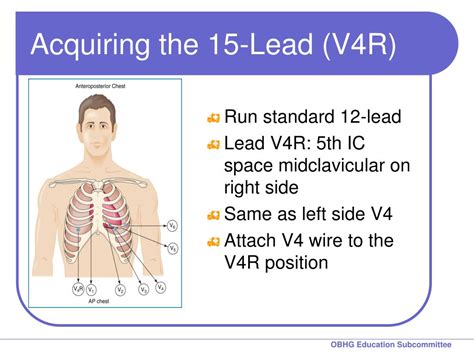 Ppt Chapter 8 For 12 Lead Training The 15 Lead Ecg Powerpoint