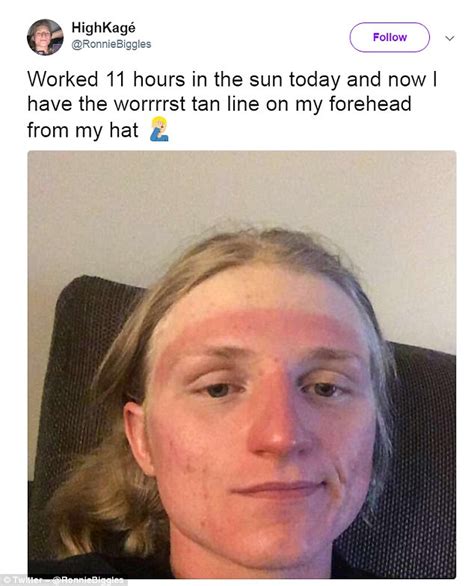 Burnt Brits Show Off Their Very Dodgy Tan Lines Daily Mail Online