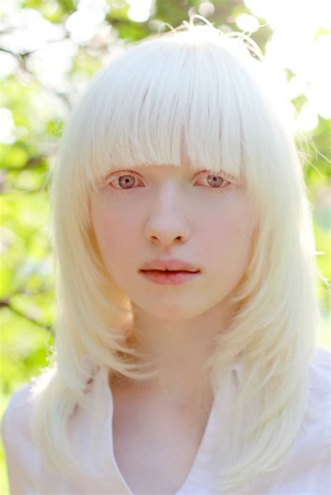 Pin On Albino Beauty