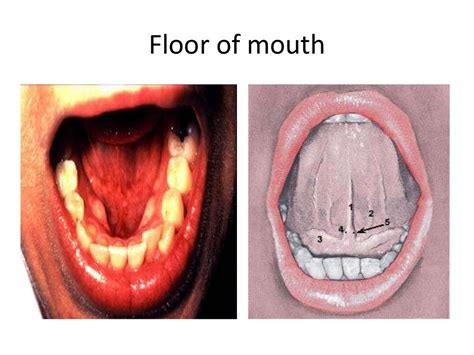 Oral Cavity And Salivary Gland Anatomy Kathryn Boyce