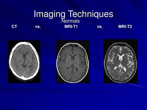 Ppt Neuroradiology For Medical Students Powerpoint Presentation Free