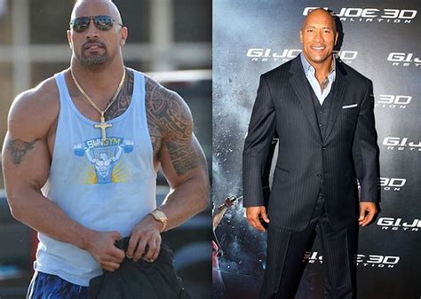 The Rocks Before And After Plastic Surgery Photos Are A Testament To