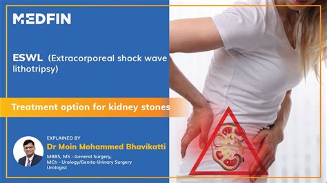Eswl Extracorporeal Shock Wave Lithotripsy Surgery For Kidney Stones