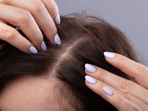 Tired Of Itchy Pimples On Your Scalp Heres What You Can Do To Treat