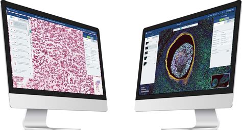 Digital Pathology Solution Image Data Solutions Glencoe Software Inc