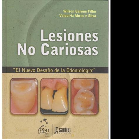 Lesiones No Cariosas El Nuevo Desafío De La OdontologÍa Interbooks