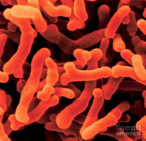 Bifidobacterium Pullorum 5 Photograph By Scimat Pixels