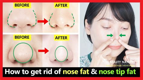 how to make a bulbous nose smaller without surgery tutorial pics