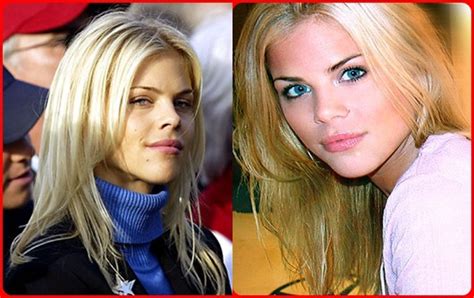 Elin Nordegren S Boob Job Before And After Images The Best Porn Website