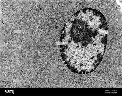 Transmission Electron Micrograph Tem Showing The Nucleus With A