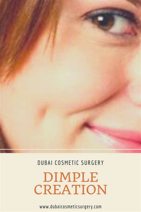 Dimple Creation In Dubai Dimple Surgery Dubai Cosmetic Surgery® In 2021 Cosmetic Surgery