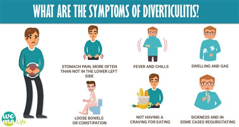 Diverticulitis Causes Symptoms Treatments And Prevention