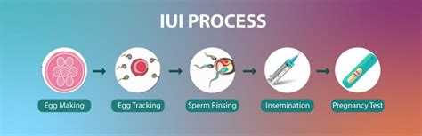 Iui Procedure Step By Step Intrauterine Insemination Dr Gunjan Gupta