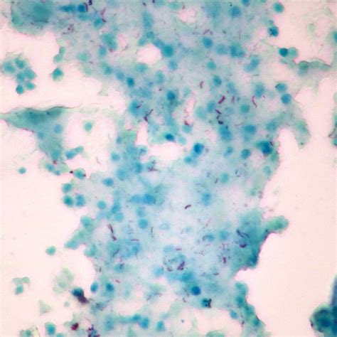 Mycobacterium Tuberculosis Microscope