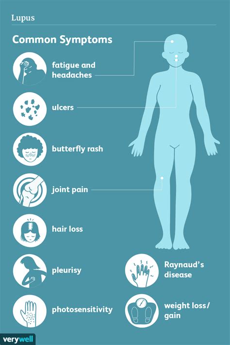 Lupus Signs Symptoms And Complications Lupus Signs Lupus Symptoms