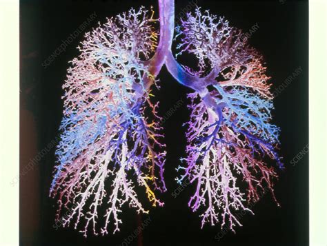 Lung Airways Stock Image P5800114 Science Photo Library
