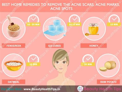 Acne scars are like adding insult to injury. How To Get Rid Of Acne Scars, How To Remove Acne Scars