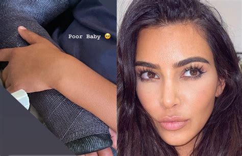 Kim Kardashian S Son Saint Breaks His Arm Blacgoss