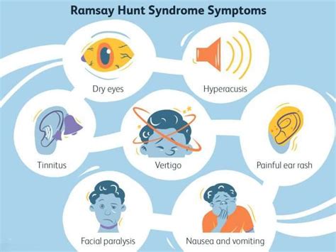 Ramsay Hunt Syndrome Causes Symptoms Diagnose Treatments Recovery