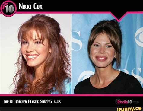 Top 10 Botched Plastic Surgery Fails Before And After 10 Nikki Cox