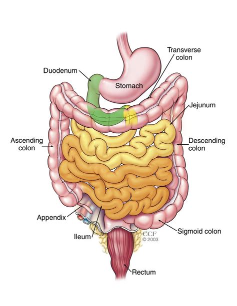 Small Bowel Obstruction Causes Symptoms Diagnosis And Treatment