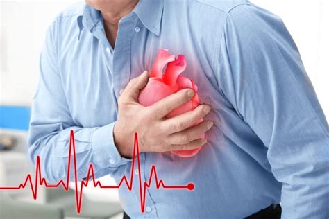 Heart Attack Can You Get Disability Benefits