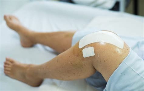 15 Things You Need To Know About Knee Replacement The Healthy