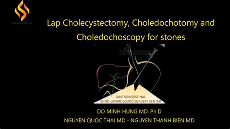 Lap Chole Choledochotomy And Choledochoscopy For Stones Youtube