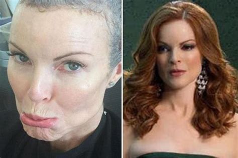 Desperate Housewives Star Marcia Cross Reveals Shes Happy And Healthy After Secret Battle