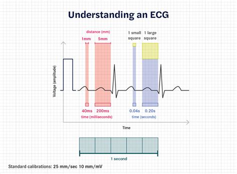 How To Calculate Heart Rate From Ecg Seer Medical Au