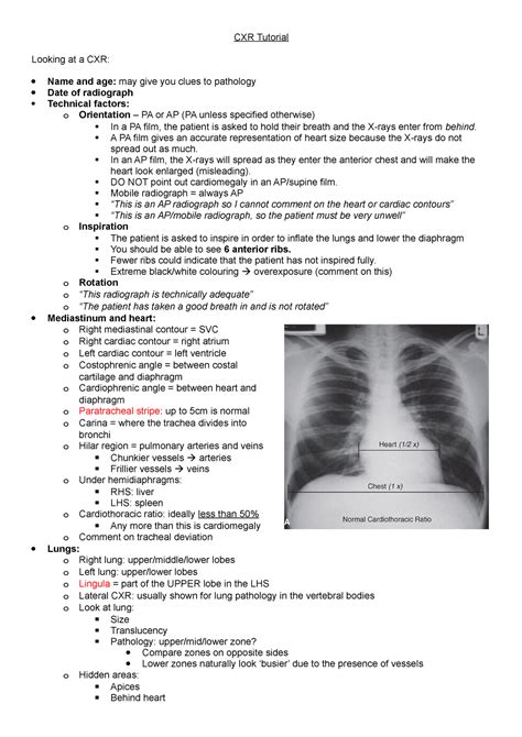 Radiology Notes For Chest Medicine Cxr Tutorial Looking At A Cxr
