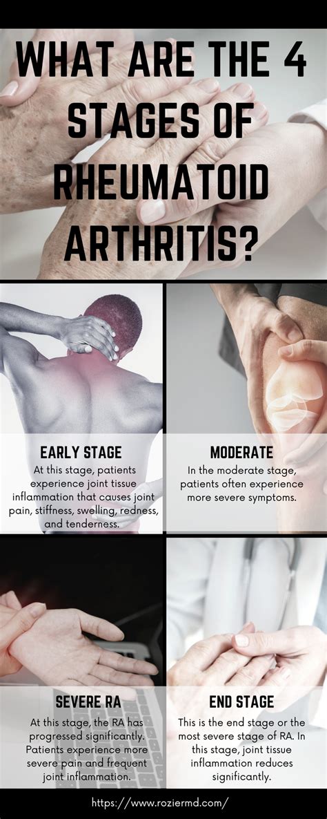 Rheumatoid Arthritis Stages Symptoms And Treatments