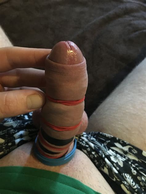 Cock And Ball Bondage With Rubber Bands And Cockrings Pics XHamster