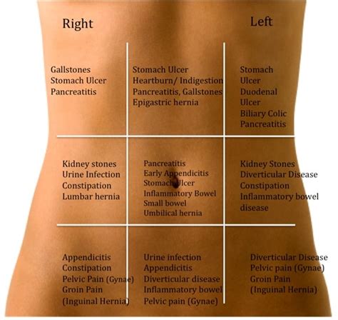 Abdominal pain can have a wide range of causes. Body quadrants | ATE LYDS SIMPLE TIPS | Pinterest