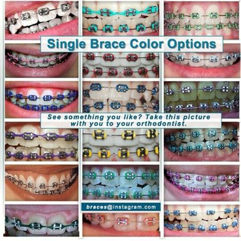 Braces For Teeth Colors