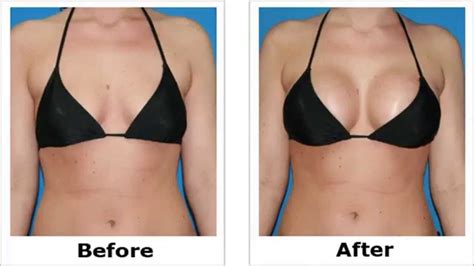 home remedies to lift up sagging breasts effective remedies to lift your breast in a natural