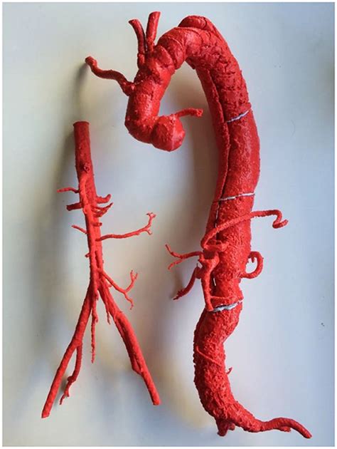 Frontiers Accessing 3d Printed Vascular Phantoms For Procedural