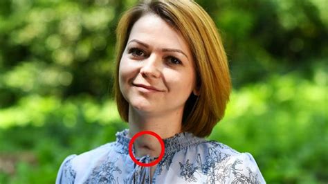 ex spy s poisoned daughter yulia skripal recovering with neck scar pictures