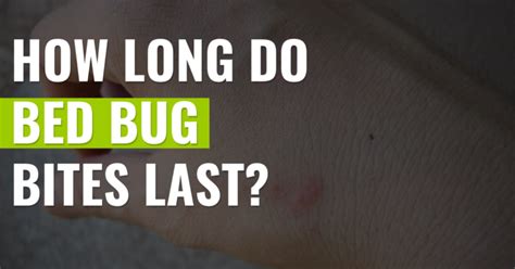 How Long Do Bed Bug Bites Last Full Guide Pest Resources