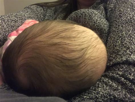 Help Elongated Baby Head Shape Babycenter