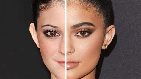 KYLIE JENNER: Before and After Plastic Surgery - YouTube