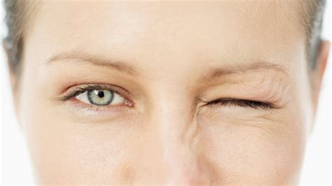 Tratamiento Para Tic Nervioso En El Ojo Consejos Ojos