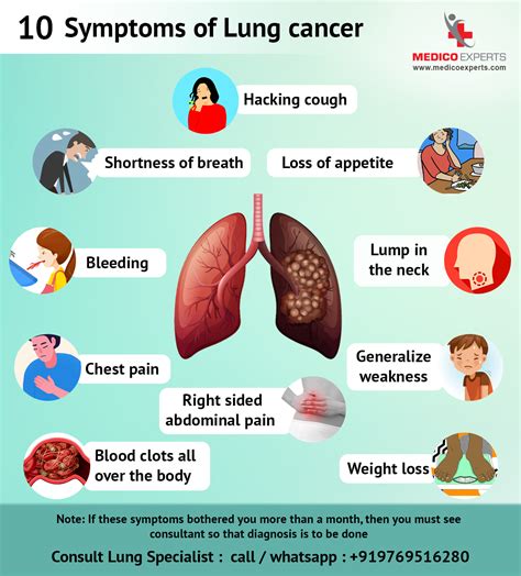 Lung Cancer Symptoms All Most Common Signs Of Lung Cancer Full Hot My Xxx Hot Girl