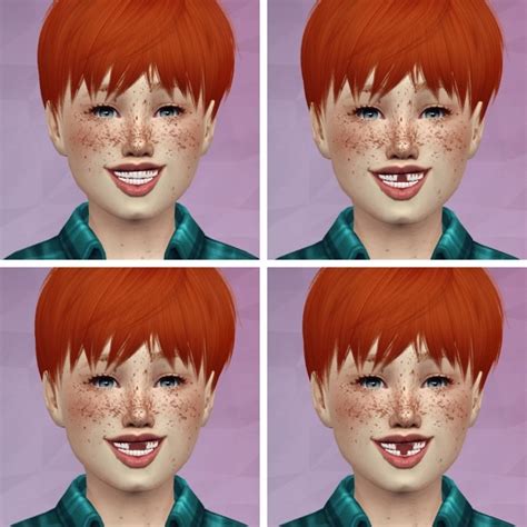 3d Realistic Teeth Child Version By Thiago Mitchell At Redheadsims