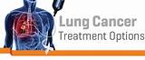 Lung Cancer Treatment In Israel Images