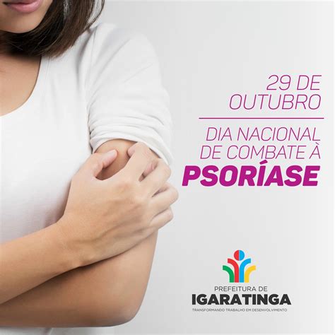 Psoríase palmar cerca de 1 ou 2 mês do aparecimento da pequena lesão inicial era outubro de 2008 quando uma pequena. Site Oficial da Prefeitura Municipal de Igaratinga - 29/10 ...